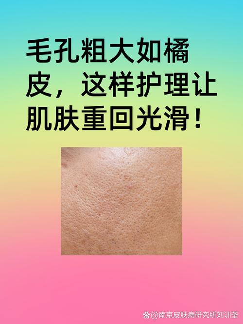 毛孔粗大如橘皮？掌握这五个护理步骤，轻松重拾光滑细腻肌